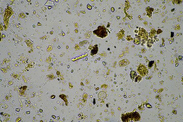 Microorganisms and biology in Compost and soil sample under the microscope