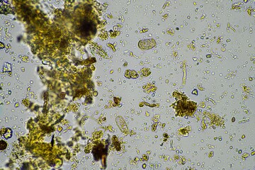 Microorganisms and biology in Compost and soil sample under the microscope
