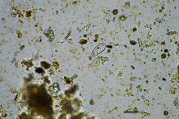 Microorganisms and biology in Compost and soil sample under the microscope