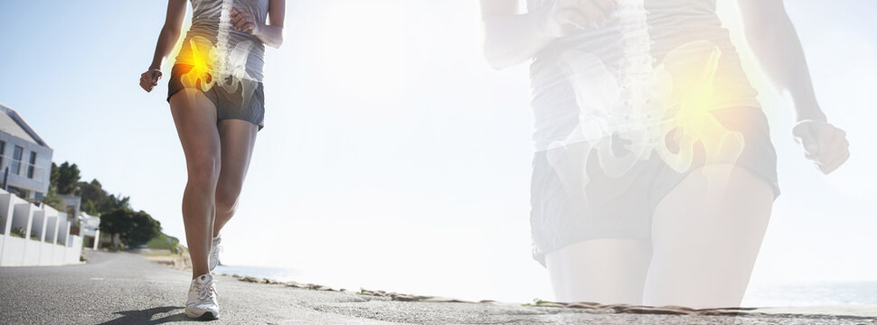 Runner legs, hip injury and x ray on banner outdoor, fitness and exercise anatomy for body health on road. Pain, arthritis and woman with bone, fibromyalgia glow and osteoporosis double exposure