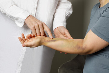 Doctor examining bruises on her patient's arm. Medicine and treatment concept