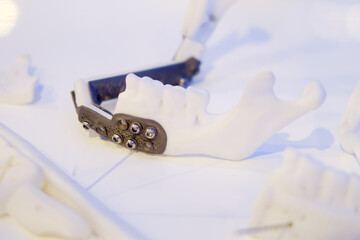 Dental prosthetics tools of the jaw bone on a white background close-up.