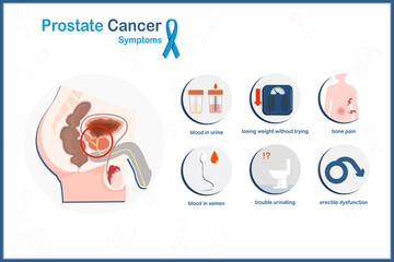 Vector medical illustration in flat style, prostate cancer concept.Prostate cancer symptoms.trouble urinating,bone pain,weight loss,blood in urine and semen,erectile dysfunction.flat style.