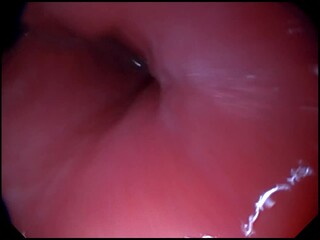 Gastroscopy examination of the gullet and stomach