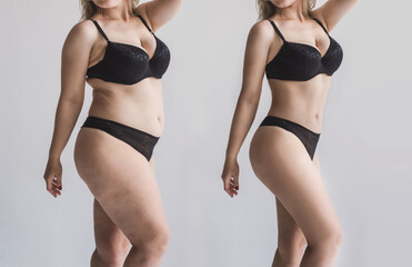 woman's body before and after losing weight without face. unrecognizable female figure after...