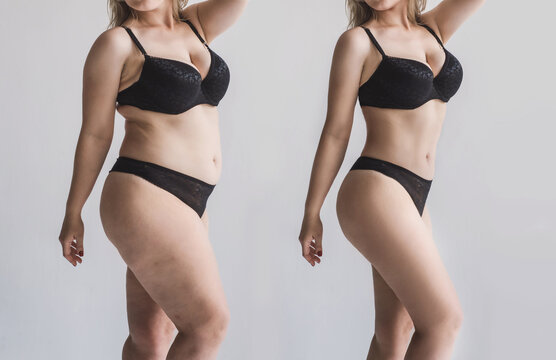 woman's body before and after losing weight without face. unrecognizable female figure after liposuction