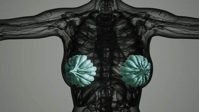 medical scan of Woman Breast Cancer