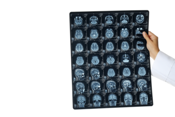 PNG, MRI images of a human head in the hands of a doctor, isolated on white background