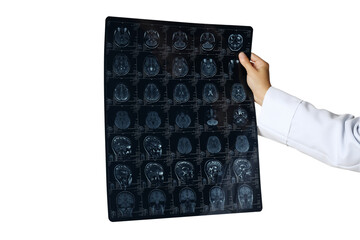 PNG, MRI images of a human head in the hands of a doctor, isolated on white background