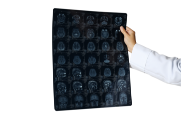 PNG, MRI images of a human head in the hands of a doctor, isolated on white background