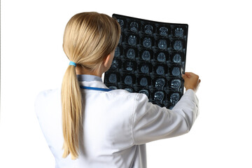 PNG, MRI images of a human head in the hands of a doctor, isolated on white background