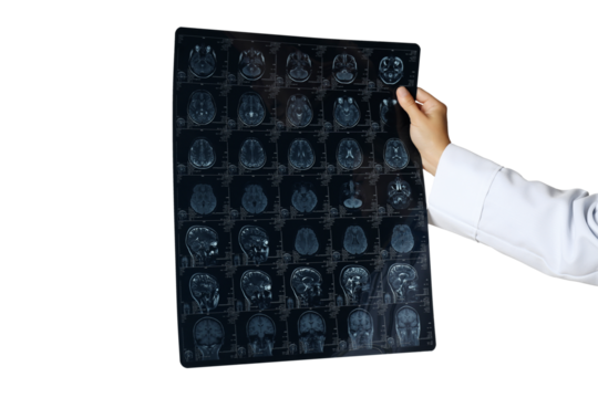 PNG, MRI images of a human head in the hands of a doctor, isolated on white background - Powered by Adobe