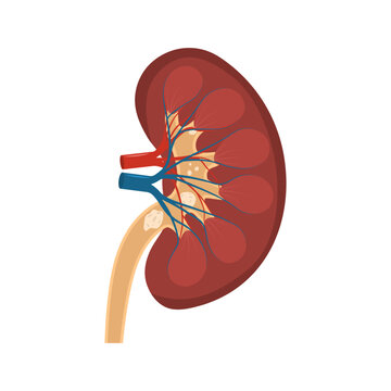 Urological diseases concept. Human kidney stones vector illustration