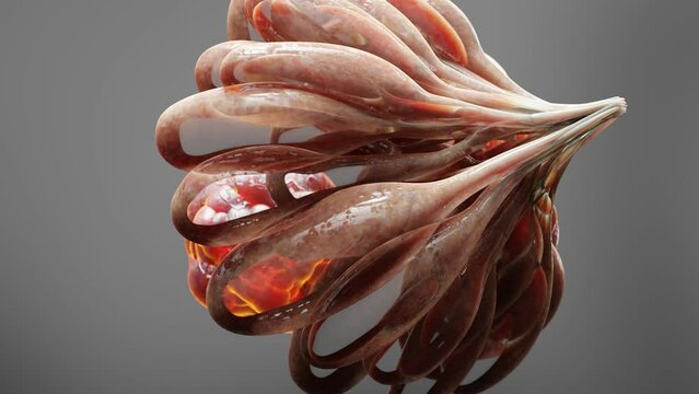 breast malignant tumor, Female breasts anatomy, mammary gland cancer, Mammogram, growing cells over breast tissue, inflammation and metastasis cancerous, tumors lumps duplicating, 3d render