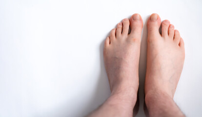Photo of man's feet on white floor, health and foot care theme