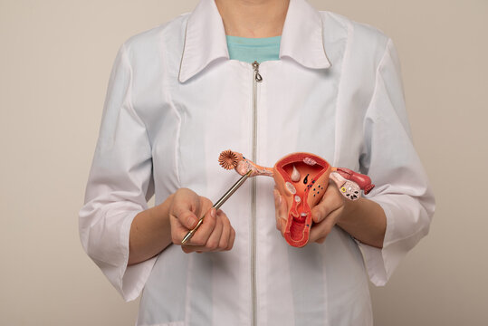 Doctor gynecologist showing pen on plastic model of uterus and ovaries closeup