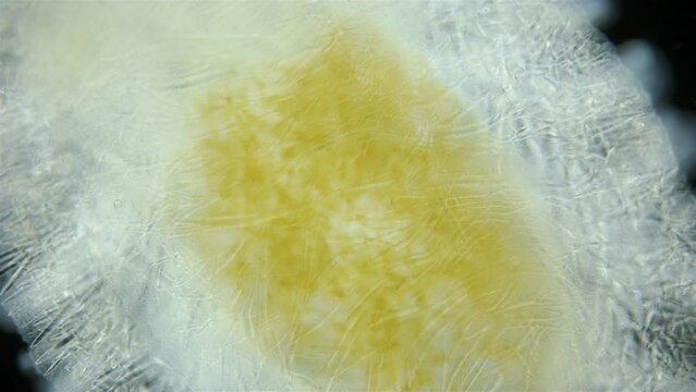 Sea slug Nudibranchia under microscope, Onchidorididae, genus Onchidoris. Spicules are clearly visible, which have two main functions: