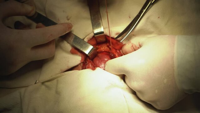 doctor strangulating the veins and artery
