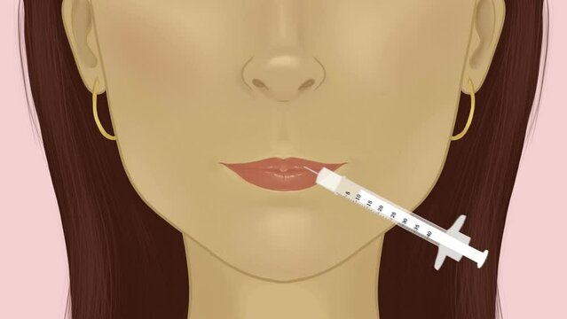 Woman getting lip fillers 4k animation, cosmetic procedures for increasing lip volume, green screen included
