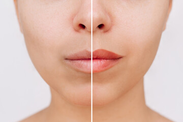 Result of lip tattooing. Young woman's lower part of face with lips before and after permanent makeup. Changing brightness and volume. Clear outline. Cosmetology, beauty. Contouring with a lip pencil