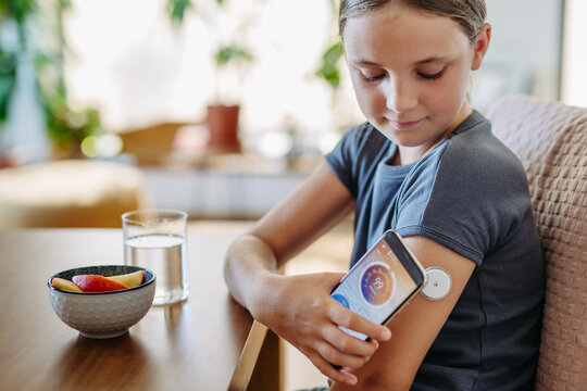 Girl with diabetes checking blood glucose level at home using continuous glucose monitor. Schoolgirl connecting CGM to smartphone, monitoring her blood sugar levels in real time.