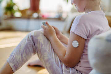 Diabetic girl with continuous glucose monitor on arm. The CGM device makes the life of schoolgirl easier, helping manage illness and focus on other activities.