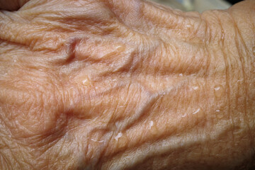 Senior woman's wet wrinkled skin texture of blood in back of right hand, Close up & Macro shot, Selective focus, Asian body skin part, Healthcare concept