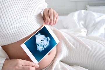 A young blonde woman waiting for a baby is sitting on a bed in a white Scandinavian interior. Pregnancy.