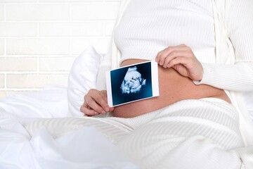 A young blonde woman waiting for a baby is sitting on a bed in a white Scandinavian interior. Pregnancy.