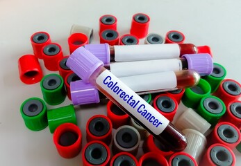 Blood sample for Colorectal Cancer test