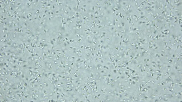 Sperm (spermotozoa) sea urchin Strongylocentrotus pallidus under microscope, phylum Echinodermata. White sea