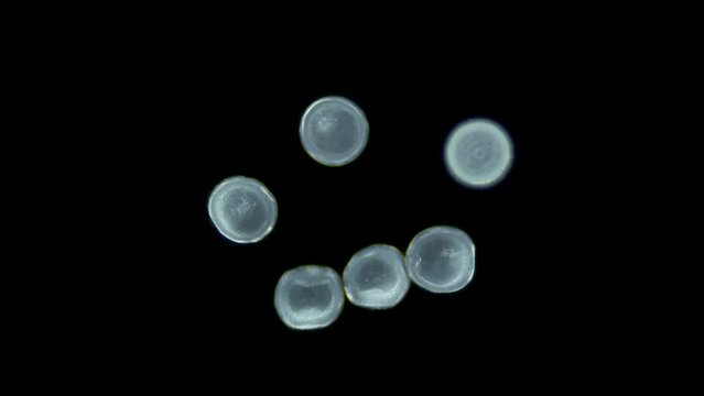 Larva sea urchin Strongylocentrotus pallidus under microscope, phylum Echinodermata. Early blastula stage. White sea