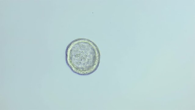 Larva sea urchin Strongylocentrotus pallidus under microscope, phylum Echinodermata. Early blastula stage. White sea