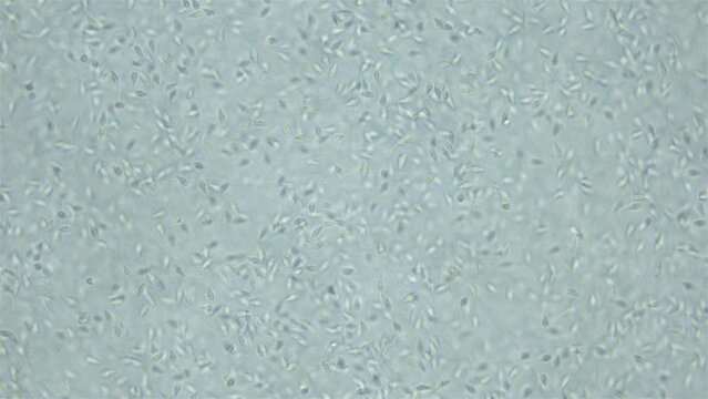 Sperm (spermotozoa) sea urchin Strongylocentrotus pallidus under microscope, phylum Echinodermata. White sea