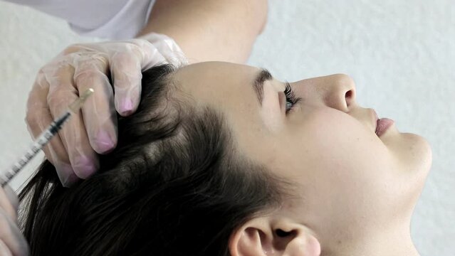 Close-up shot of plasma injections anti hair loss procedure. Young female patient prp procedure for hair regrowth
