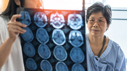 Brain disease diagnosis with medical doctor diagnosing elderly ageing patient neurodegenerative...