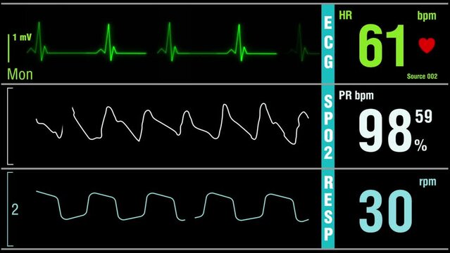 Heart rate, pressure rate, oxygen saturation, respiration indication. Mock up, banner, ICU monitor or display in a hospital. Medical and science clip. Cardiogram footage.