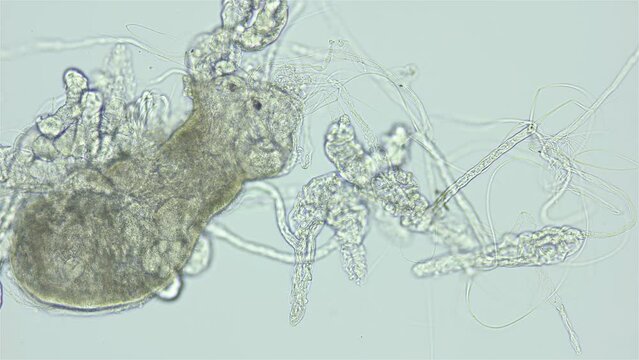 Larvae of parasitic worm Progonus muelleri under a microscope, at Cercaria stage. Class Trematoda. Got out of Sporocyst. White Sea