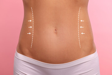 Fototapeta na wymiar Woman with markings for cosmetic surgery on her abdomen against pink background, closeup