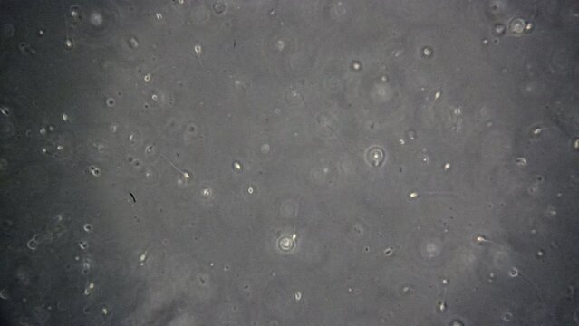 Sperm cells, some swimming, some dead, seen through microscope.
