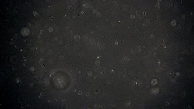 Microscopic sperm cells swimming in semen.