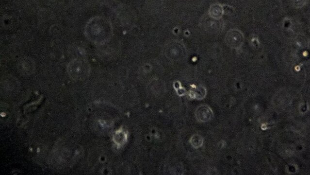 Individual sperm cells seen through a phase contrast microscope.