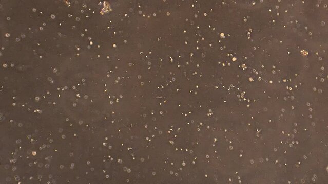 Human sperm cells swimming in seminal fluid. Camera defocuses at end.