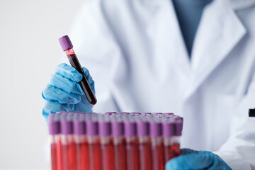 Doctor hand taking a blood sample tube from a rack with machines of analysis in the lab background,...