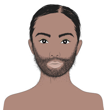 Hypertrichosis, excessive hair growth, either in quantity or thickness, on any part of the body.