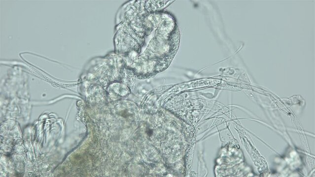 Larvae of parasitic worm Progonus muelleri under a microscope, at Cercaria stage. Class Trematoda. Got out of Sporocyst. White Sea