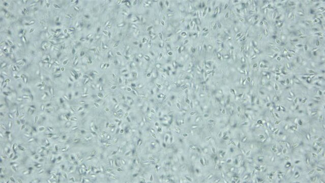 Sperm (spermotozoa) sea urchin Strongylocentrotus pallidus under microscope, phylum Echinodermata. White sea