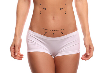 Fototapeta na wymiar Woman with markings for cosmetic surgery on her abdomen against white background, closeup