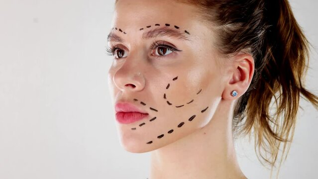 Facial Aesthetics Facelift. Plastic Surgery Drawings