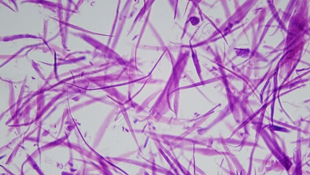 A bundle of human smooth muscle fibers under a microscope. The main muscle of the human internal organs from the intestines to the bladder, etc. 400x times magnification.